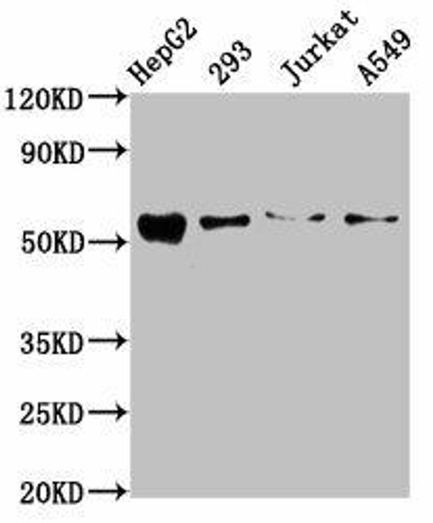 ZDHHC14 Antibody (PACO60212)