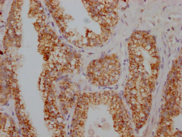 S100A12 Antibody (PACO64091)