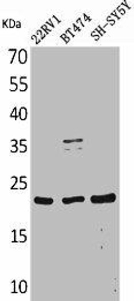 FGF12 Antibody (PACO01875)