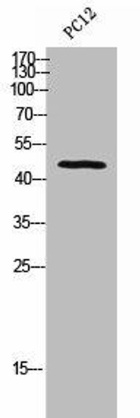 BMP15 Antibody (PACO02270)