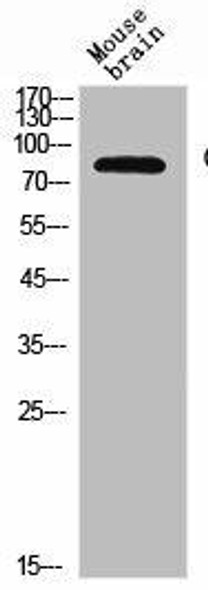 CD180 Antibody (PACO06913)