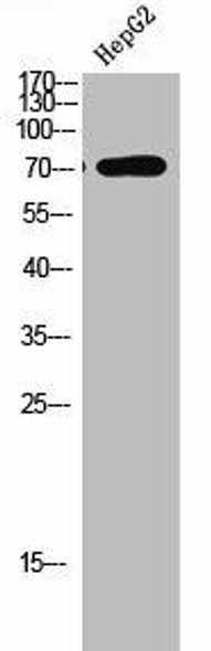 LIMK1/LIMK2 Antibody (PACO07099)