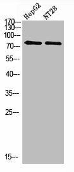 RPS6KA2 Antibody (PACO07300)