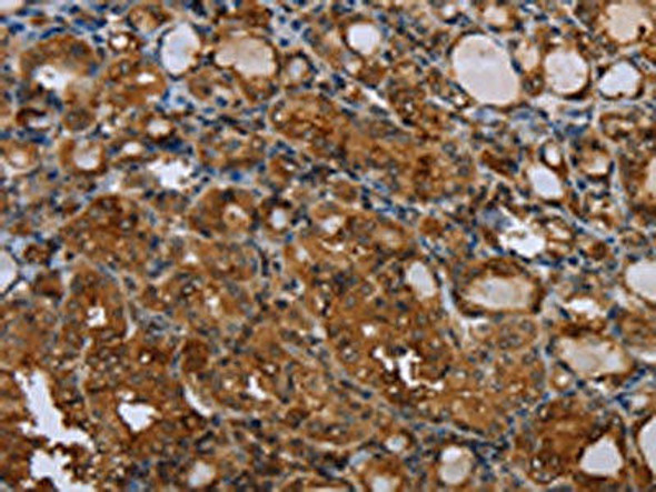 CSF2RA Antibody (PACO18010)