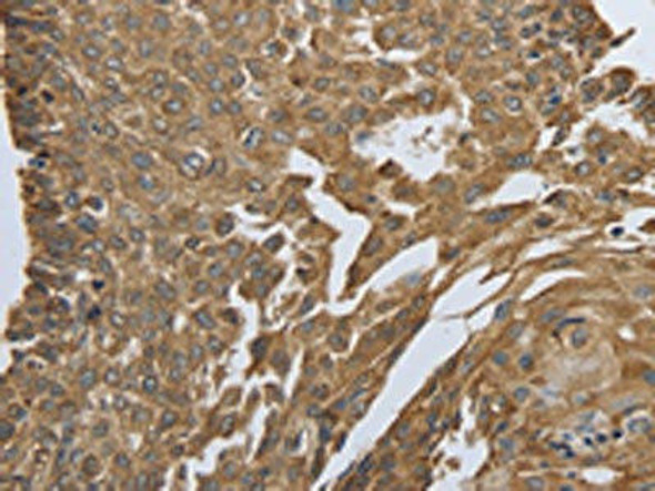 MYH11 Antibody (PACO18417)