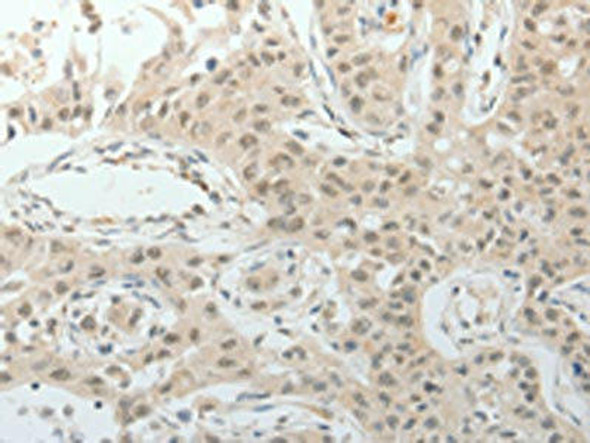 TOP1MT Antibody (PACO18453)