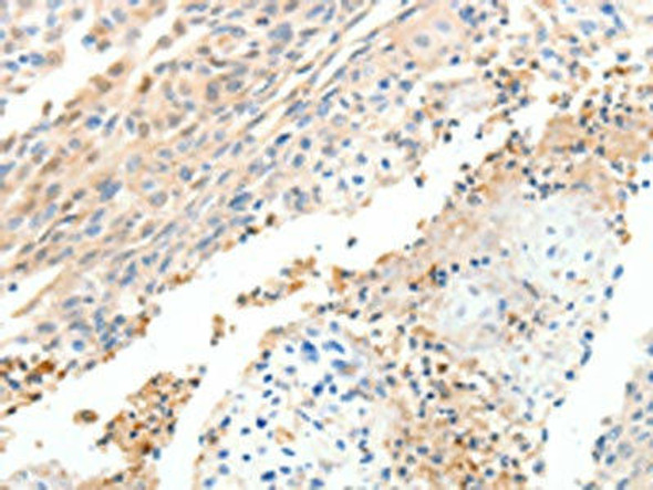 CXCL12 Antibody (PACO18881)