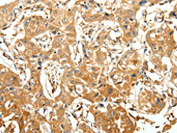 SLC27A1 Antibody (PACO18902)