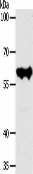 KRT10 Antibody (PACO19040)