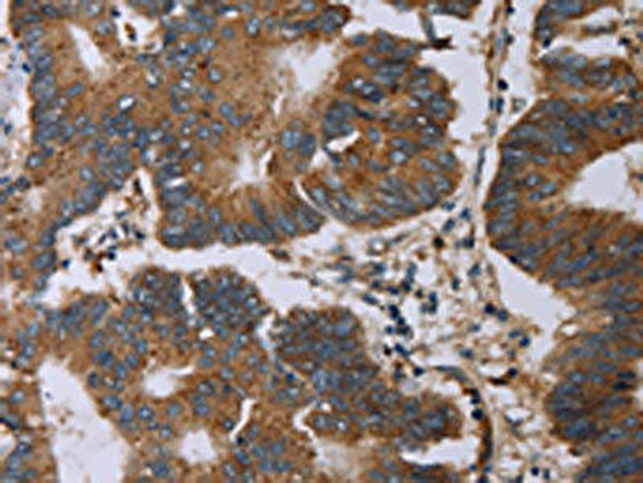 MAP3K11 Antibody (PACO20026)