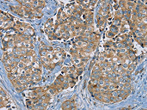 PUS10 Antibody (PACO20297)