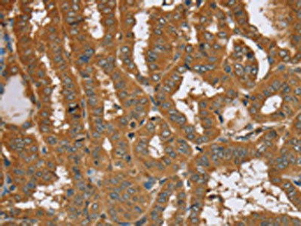 RAB14 Antibody (PACO20302)