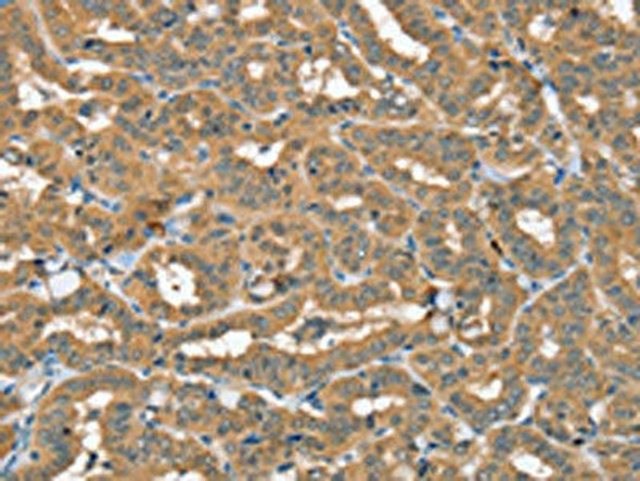 SEC14L2 Antibody (PACO20417)