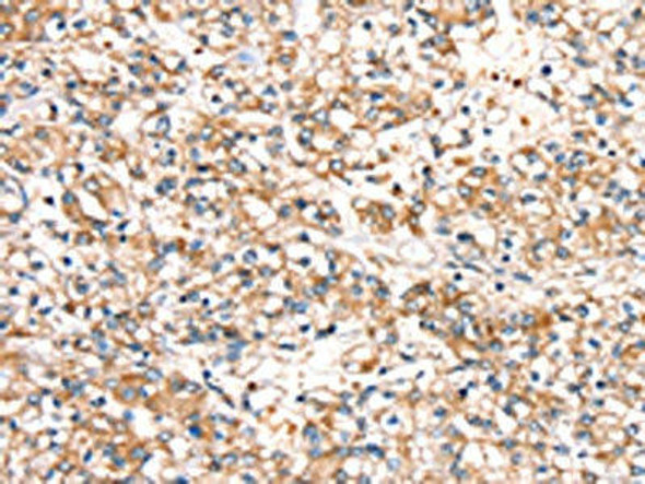 SLC24A3 Antibody (PACO20483)