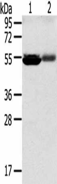 SLC17A1 Antibody (PACO20540)