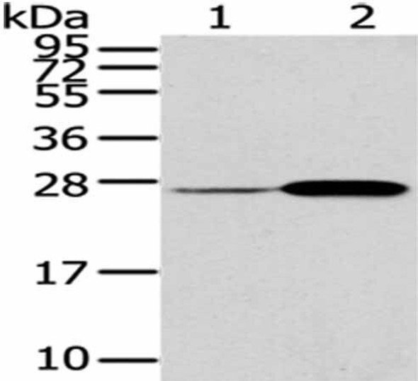 CD79A Antibody (PACO20891)