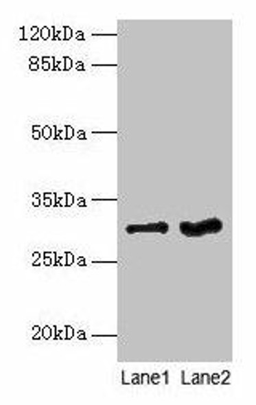 FGFR1OP2 Antibody (PACO26761)