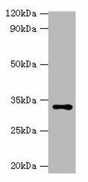 HSD11B1 Antibody (PACO27457)