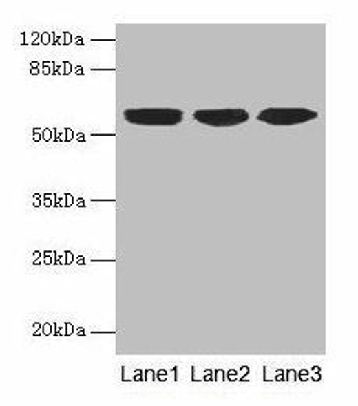 KRT10 Antibody (PACO27845)