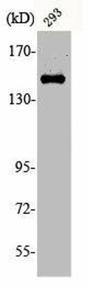 Phospho-MET (Y1349) Antibody (PACO00234)