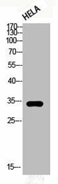 Phospho-CDK1 (T161) Antibody (PACO06104)