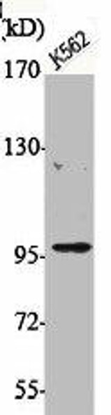 Phospho-IGF1R (Y1165/Y1166) Antibody (PACO06131)