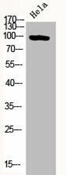 Phospho-PRKD2 (S876) Antibody (PACO06164)