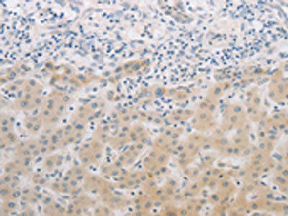 PGA3/PGA4/PGA5 Antibody (PACO18354)