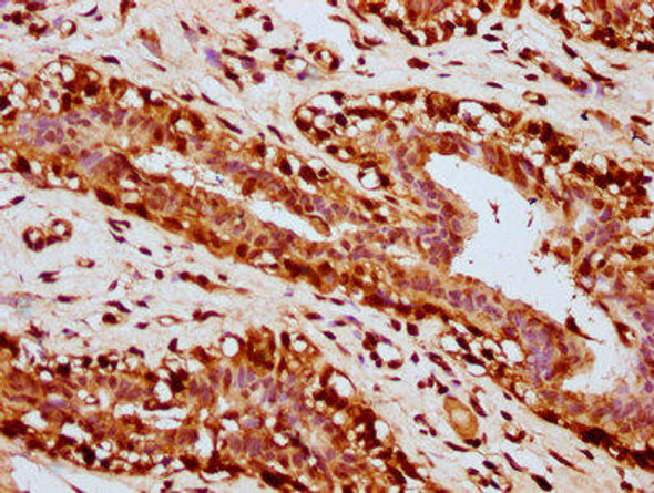 HIST1H4A (Ab-31) Antibody (PACO60598)