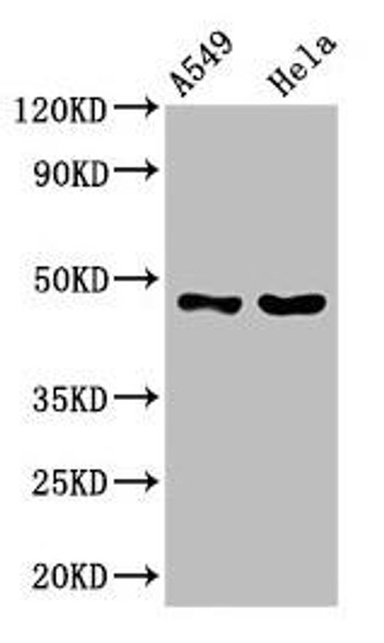 SLC16A11 Antibody (PACO61105)