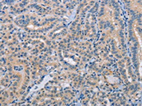 NLRP3 Antibody (PACO13943)