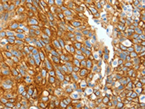 KRT2 Antibody (PACO14058)