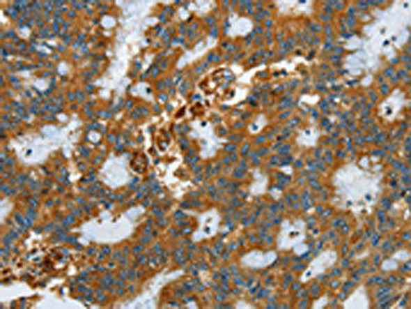 SEPT9 Antibody (PACO14101)