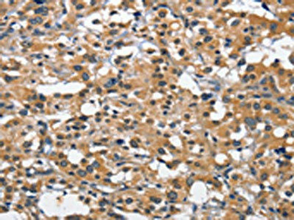 CEACAM3 Antibody (PACO14234)