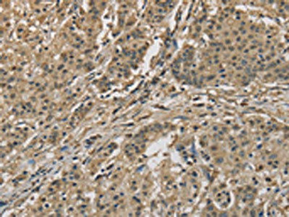 CYCS Antibody (PACO14322)