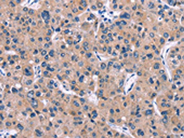 DKK4 Antibody (PACO14343)