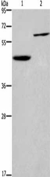 DOK1 Antibody (PACO14351)
