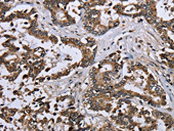 DUSP4 Antibody (PACO14397)