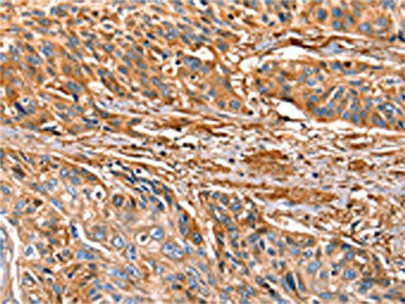 LGALS1 Antibody (PACO14442)