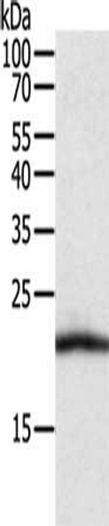 CSF2 Antibody (PACO14471)