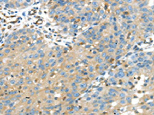 IGFBP4 Antibody (PACO14554)