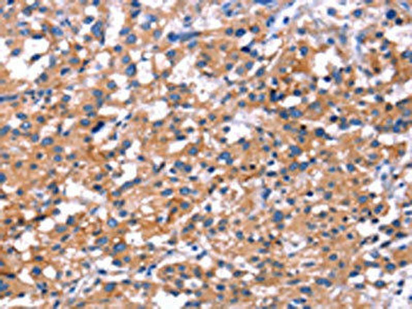 IRS1 Antibody (PACO14608)