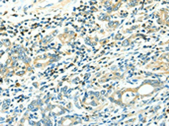 LYVE1 Antibody (PACO14663)