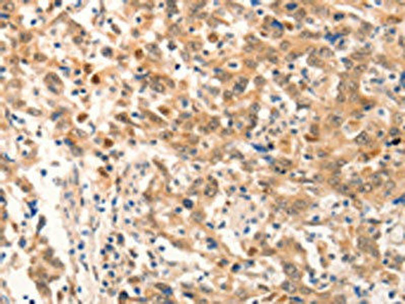 NOX4 Antibody (PACO14781)