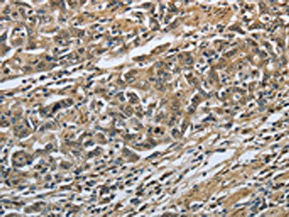 PRDX6 Antibody (PACO14913)