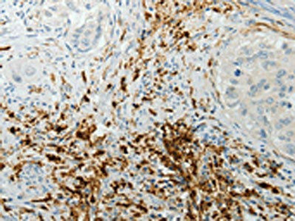 F13A1 Antibody (PACO15093)