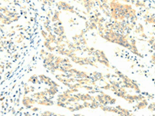 TERF1 Antibody (PACO15146)
