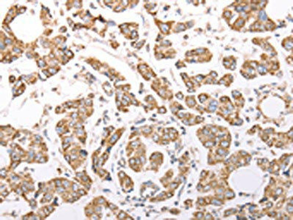 ATPIF1 Antibody (PACO15185)