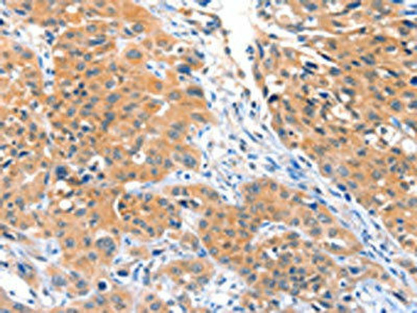 ACOX3 Antibody (PACO15265)