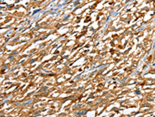 CAPG Antibody (PACO15274)